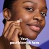 Hero Cosmetics Mighty Patch Micropoint for Dark Spots - Post-Blemish Dark Spot Patch with 395 Micropoints, Dermatologist Tested and Non-irritating (8 Count) view 2