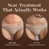Nemah - Restorative Scar Treatment for C Section Recovery - C Section Scar Treatment for Postpartum - Reduces the Appearance of Scars from Acne - Vegan & Cruelty-Free - 1 oz. view 2