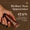 Nemah - Restorative Scar Treatment for C Section Recovery - C Section Scar Treatment for Postpartum - Reduces the Appearance of Scars from Acne - Vegan & Cruelty-Free - 1 oz. view 4