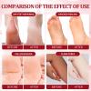 nbc BeautiLab Pedicure Kit Foot Soak Set: Bubble Salt, Sugar Scrub, Massage Mask, Massage Lotion in a Box, 4 Step Foot Spa Kit for Dry Feet,Tired Feet3 Set Pomegranate) view 3