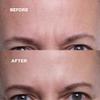 Wrinkles Schminkles Forehead Wrinkle Patches & Under Eye Wrinkle Patches Bundle Set view 4