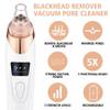 Electric Blackhead Remover Vacuum Acne Cleaner Black Spots Removal Facial Deep Cleansing Pore Cleaner Machine Skin Care Tools, White, 1 count (Pack of 1) view 3