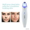 Microdermabrasion Machine - Appolus Premium Diamond Microdermabrasion Device Tool - 2 Diamond Tips - 5 Heads - Blackhead Blemishes Remover - Pores Fine Lines Minimizer view 3