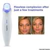 Microdermabrasion Machine - Appolus Premium Diamond Microdermabrasion Device Tool - 2 Diamond Tips - 5 Heads - Blackhead Blemishes Remover - Pores Fine Lines Minimizer view 4