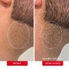 First Aid Beauty - Ingrown Hair Pads with BHA + AHA - Aftershave Treatment Pads to Help Prevent Razor Bumps for Men & Women - Exfoliate Underarms & Bikini Area - Compostable for Daily Use - 60 Pads view 4