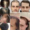 Biotin Hair Growth Serum for Hair Loss Regrowth Treatment for Women & Men, 100% Pure Natural Ginger Essential Oil, 2 Fl Oz / 30ML (2 PCS) view 4