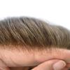 Toupee For Men Hair Piece For Men Swiss Lace Front Mens Toupee Natural Hairline Remy Human Hair Replacement System (8x10''-100% Light to medium Density, 5# Medium Light Brown) view 3