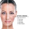 Carbon Gel Peel Skin Care Skin Rejuvenation Black Doll Facial Skin Deep Cleaning 80ML Elitzia ETBDF22 Pack of 2 view 3