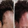 Supergrowth hair Serum (2 oz) view 3