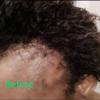 Supergrowth hair Serum (4 oz) view 3