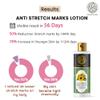 Buddha Natural Anti-Stretch Marks Body Lotion - Reduce Visible Stretch Marks - 100% Natural (150 Ml (Pack Of 1)) view 2
