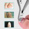 pizarra Professional Feet Nail Clippers Trimmer Paronychia Nippers Podiatry Stainless Tools view 3