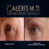 ALEXIS M.D. Moisturizing Cleanser | 100ml | 3.3oz view 2