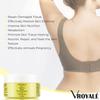 VROYAL Stretch Mark Removal Cream [2-Pack] - Natural Organic Skin Healing & Pregnancy Scar Repair Cream, Dermatologist Tested Moisturizing Body Cream - Restore Damaged Tissue, Nourish & Soften Skin view 4