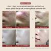 [BQCELL] [Made In Korea] [DERMA SKIN PEELING 2g / Recell Cure Serum 2ml, Safety Cap 1ea, 3set], Acne Skin Available, Exfoliating, Facial Scrub, Korean Beauty, Blackhead Remover view 3