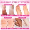nbc BeautiLab Pedicure Kit Foot Soak Set: Bubble Salt, Sugar Scrub, Massage Mask, Massage Lotion in a Box, 4 Step Foot Spa Kit for Dry Feet, Softens Calluses, Soothes Sore, Tired Feet3 Set Rose) view 3