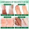 nbc BeautiLab Pedicure Kit Foot Soak Set: Bubble Salt, Sugar Scrub, Massage Mask, Massage Lotion in a Box, 4 Step Foot Spa Kit for Dry Feet, Softens Calluses(3 Set Cucumber) view 3