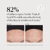Naturium Azelaic Topical Acid 10% Jumbo, Face & Skin Care Beauty Treatment with Niacinamide & Vitamin C, 2 oz view 4