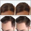 Boobeen Hairline Powder Stick for Thinning Hair, Touch-Up and Root Concealer for Hair Loss view 2