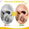 Nose Wax Kit Men and Women with 30 Applicators (20-30 Uses), Nose Hair Wax Kit for Nose & Ear Hair Removal, Painless & Fast, Long-Lasting Results Up to 5 Weeks (120g Nose Wax) view 4