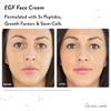 Nurse Jamie NON-SURGICAL FACE UPLIFT KIT: UPLIFT & EGF FACE CREAM view 4