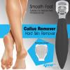 YNR Foot Scraper, Hard Skin Foot Shaver Foot File Pedicure Feet Care Set, Premium Stainless Steel Foot Care Tools for Dry Wet Foot Heel, Dead, Cracked Skin (Black) view 2