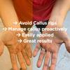 Callus Performance Healing Salve | Helps Heal callous Rips on Hands - Designed for: Gymnastics, Weight-Lifting, Cross Training, Gym, Rock Climbers | Moisturize Skin Properly | Original Scent Jumbo view 3