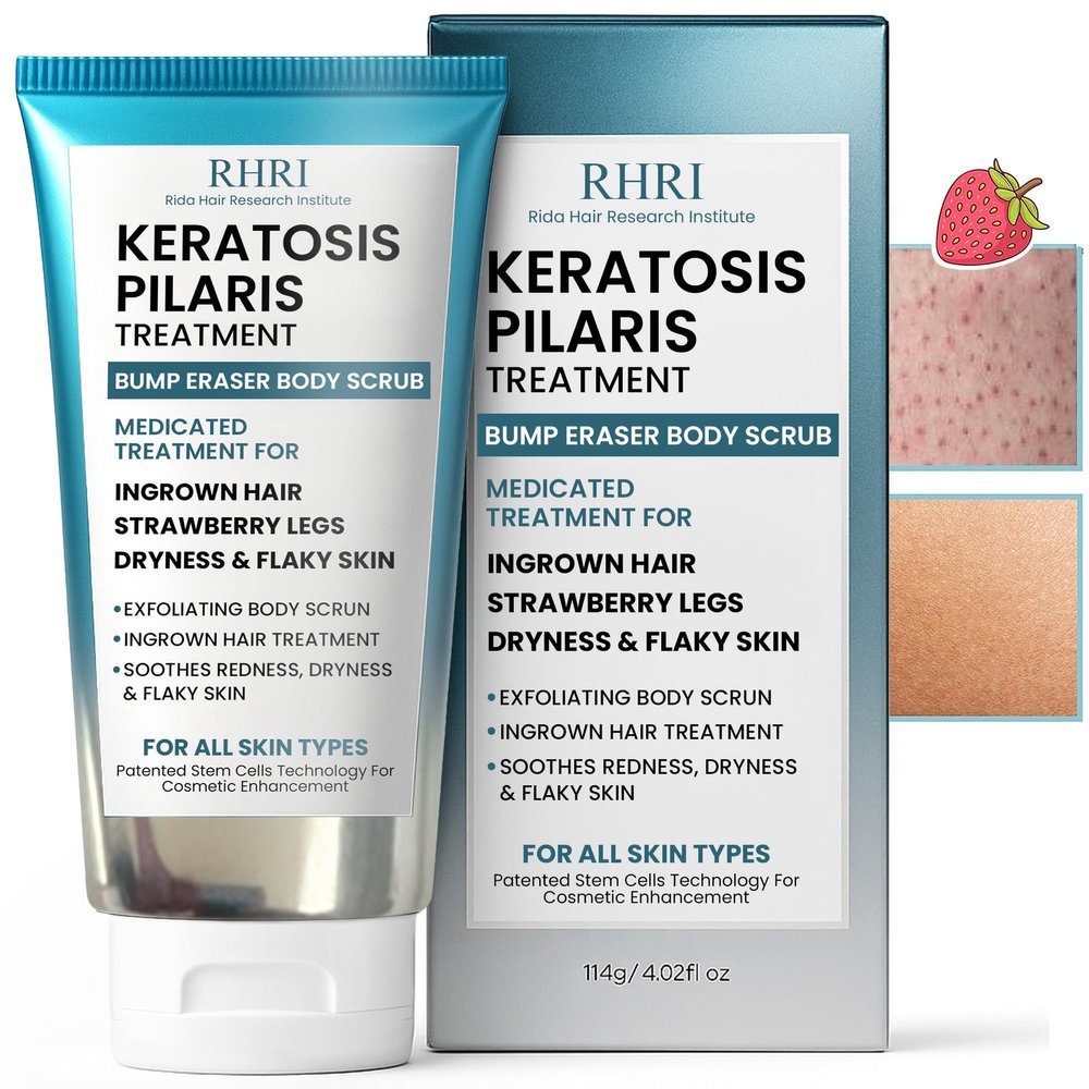 KP Bump Eraser Body Scrub | Keratosis Pilaris Treatment | Bump Eraser Body Scrub | Exfoliating Body Scrun | Ingrown Hair Treatment | Clears Strawberry Legs | Soothes Redness, Dryness & Flaky Skin