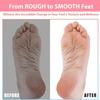 Efforest Shower Foot Scrubber Mat with Pumice Stone - Cleans, Smooths & Removes Dead Skin on Foot Without Bending, Foot Callus Remover with Non-Slip Suction Cups, Foot Scraper for Shower & Bathtub view 4