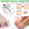 Ingrown Toenail Removal Kit, Ingrown Toenail Tool for Ingrown & Thick Nail Treatment Relieves Toenail Pain, with Correction Clippers, Corrector Strips, Corrector Patch, File, Lifter Pedicure (8pcs) view 2