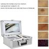 Skin Diagnosis Hair Analyzer, Skin Follicles Detector, Facial Skin Scanner with 10 Inch LCD Screen, Multi Functional Hair Follicle Skin Analyser Skin Analyzer Machine Multiple Magnification Clear Dete view 3