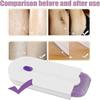 Silky Smooth Hair Remover, Silky Smooth Hair Eraser Painless Hair Removal, Rechargeable Epilator Smooth Touch Hair Remover - Light Technology Hair Remove, Apply to Any Part of The Body view 2