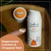 Rhino Skin Solutions Split+ Hyaluronic Acid Cream  Intensive Care for Severely Damaged skin | Heal & Regenerate Cracked, Chapped Skin (3.4oz) view 4