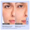 INNBEAUTY Project Pore Refine Serum for Shrinking Pores & Texture Smoothing, 1 OZ (30ml) view 4