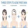 BumpKilla Acne Treatment For Sensitive Skin - 80% of Acne Gone in 4 Weeks. (Double Bottle) view 3