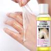 Extra Strong Peeling Oil, Yellow Peeling Oil for Dark Skin, Natural Formula Exfoliating Peels Solution for Face, Body, Hands and Foot Dead Skin Remover (220ML/7.76 OZ) view 2
