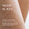 HealFast KP Bump Eraser Cream 4 Oz  Soften, Nourish Rough and Bumpy Skin with 2% BHA  Keratosis Pilaris - For All Types  No Scrubbing Required  Fragrance and Paraben Free view 2