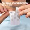 Hanhoo EraseZit Magnesium Microneedle Patch, 8 Microneedle Patches, Hydrocolloid Pimple Patches, For Deep Pimples, Calms Angry Zits, Acne Spot Patches, Microdot Pimple Patches, Korean Skincare view 4