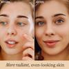 Vitamin C Face Serum - USA Made with Natural & Organic Ingredients, Skin Brightening Vitamin C Serum for Face for Women, Discoloration Correcting & Anti Aging Facial Formula with Antioxidants view 2