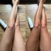 Get Into The Limelight 2 Hour Ultra Dark Starter Pack: 2 Hour Ultra Dark Sunless Tanning Mousse + Applicator Mitts view 3