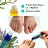 Swissklip KlearNail Toenail Stick | Medi-Care Treatment | Natural Solution for Healthy Nails I Suitable For Foot, Toe, and Fingernail I For Brittle Toenails  10ml / 0.3 Fl. Oz. Pack 1 - Made in USA view 3