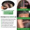 13x6 Lace Front Wigs Human Hair Pre Plucked 180 Density 26 Inch HD Body Wave Lace Front Wigs Human Hair 10A Frontal Wigs Human Hair wigs for Women Glueless Wigs Human Hair Pre Plucked Black wig view 2