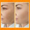 Bee and You Vitamin C Face Serum | Moisturizing Anti Aging, Reduce the Appearance of Dark Spots, Glow Up Skin Brightener with Propolis, Vitamin E & Ferulic Acid  1 fl oz view 3