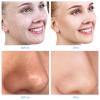 mcwdoit Facial Microdermabrasion, Diamond Dermabrasion Machine for Skin Exfoliation Blackhead Removal,Portable Rechargeable USB Cleansing Cordless White Home Device for Girl Women as a Gift, Upgraded view 4
