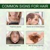 Adivasi Plus Herbal Ayurvedic Jadibuti Hair Oil for Hair Fall Control and Hair Growth with Natural Herb - 50 Ml - Pack of 2 view 4