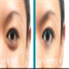 BE YOU SKIN | Skin Perfecting Conceal | RADIANT view 3