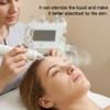 Elitzia Replacement Tip Spray Tip For Water Peel Aqua Peel Hydrofacial Parts For ETLB245 Beauty Machine view 4