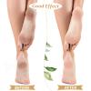 Tarpop 3 Pairs Aloe Socks Women Valentines Day Moisturizing Spa Socks for Dry Cracked Heel Feet Infused Gel Sleeping Fuzzy Lotion Gift for Women Men Softening Dry Feet(Green) view 4