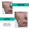 Clark's Botanicals Retinol Rescue Overnight Cream  Clinically Proven to Reduce Redness, Smooth Fine Lines & Hydrate with Time-Released Retinol, Vitamin C + Hyaluronic Acid, 60ml view 3