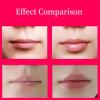 Smalibal Lip Plumper Tool, Electric Lip Plumper, Lip Plumper Device, Lip Enhancer Plumper Tool, Lip Suction Plumper 450mah White, Pack of 1 view 2